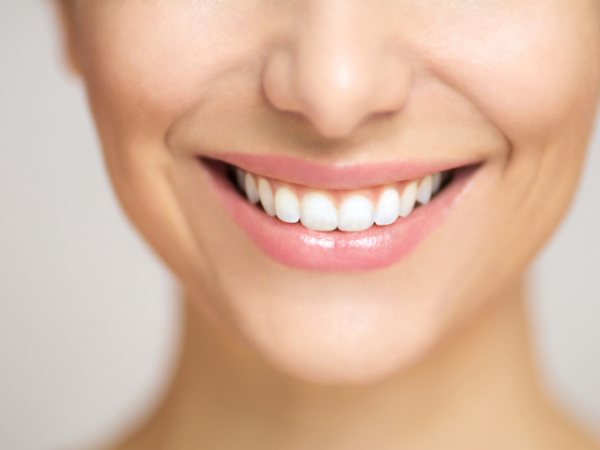 Smile Makeover